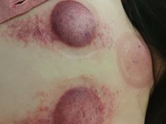 -承启堂中医馆·推拿·针灸(成华馆)