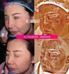 -星港国际·Skin皮肤专研·皮肤管理