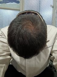 -雍禾植发全国连锁