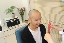 点击看大图 -大麦微针植发丨全国连锁