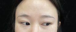 -素美医疗美容·西南眼鼻整形·修复基地