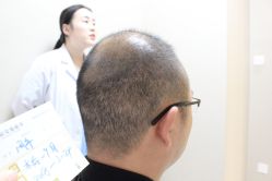 点击看大图 -大麦微针植发丨全国连锁