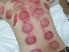-感智盲人按摩·艾灸·肩颈SPA(岗厦店)