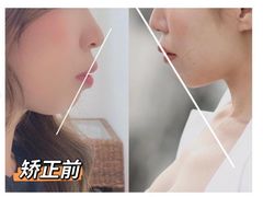 -极光口腔·矫正种植修复(锦江店)