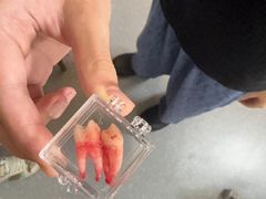 -上海仁爱医院口腔科 · 种植