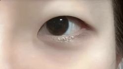 点击看大图 -郡艺医疗美容·微整·眼鼻吸脂