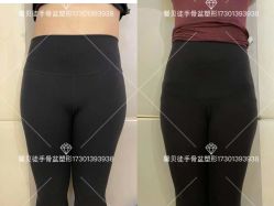-梦斯绮私密催乳修复中心