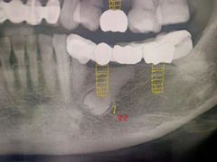 -牙易美口腔(圣堂店)