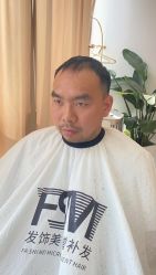 -发饰美男士增发补发假发定制店