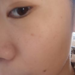 体验前-上海玫瑰医疗美容医院