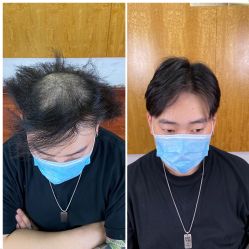 -型男帮男士假发补发·佩戴式发型