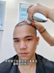 -雍禾植发全国连锁