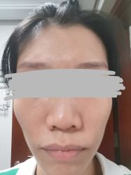 体验后-美莱医疗美容医院