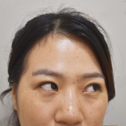 -天津健丽·去眼袋医疗美容机构