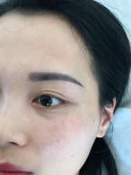 -莲姿娜半永久纹眉皮肤管理