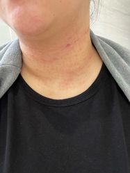 -深圳米兰柏羽医疗美容医院