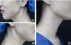 -SKINIST丽铂医疗美容