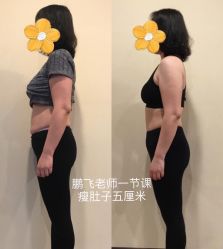 -卓拓普拉提