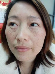 体验前-上海锦妍医疗美容门诊部