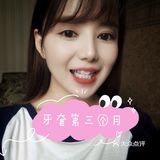 牙齿矫正案例 虎牙小美女逆袭日记