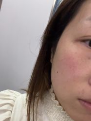 体验后-青岛诺德医学美容医院