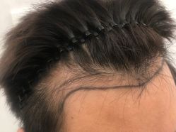 -熙朵美学植发·连锁品牌