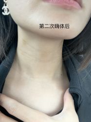 点击看大图 -小忠丽格医美