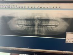 -杭州口腔医院(城西院区)