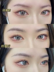 -OnFaer.纹眉半永久无创洗眉