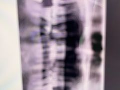 -上海仁爱医院口腔科 · 种植