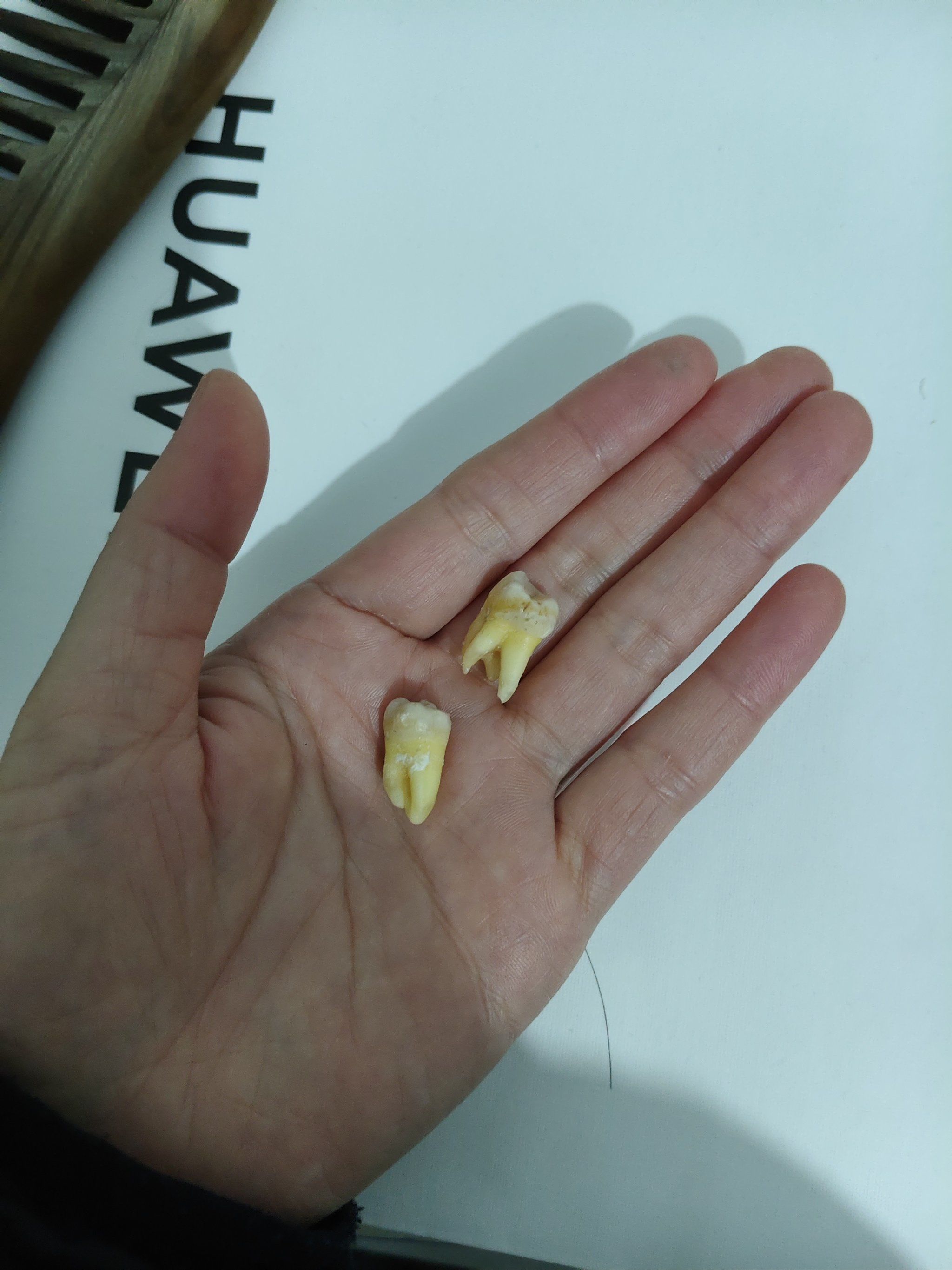 首先,人类正常牙齿就是28