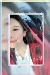 -大麦微针植发全国连锁