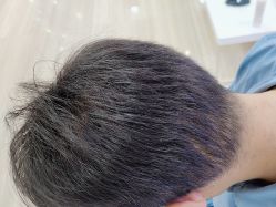 -雍禾植发全国连锁