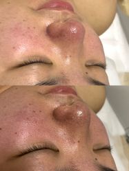-Hi Beauty Skin 科技美肤中心