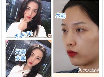 第一次体验M22来打卡啦!!
