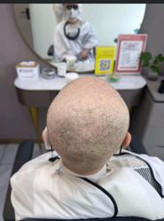 -唐风采假发补发定制