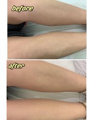 -植蔻妍倍儿专业脱毛·皮肤管理