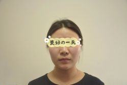 -成都西区医院整形美容