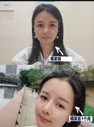 -雍禾植发全国连锁