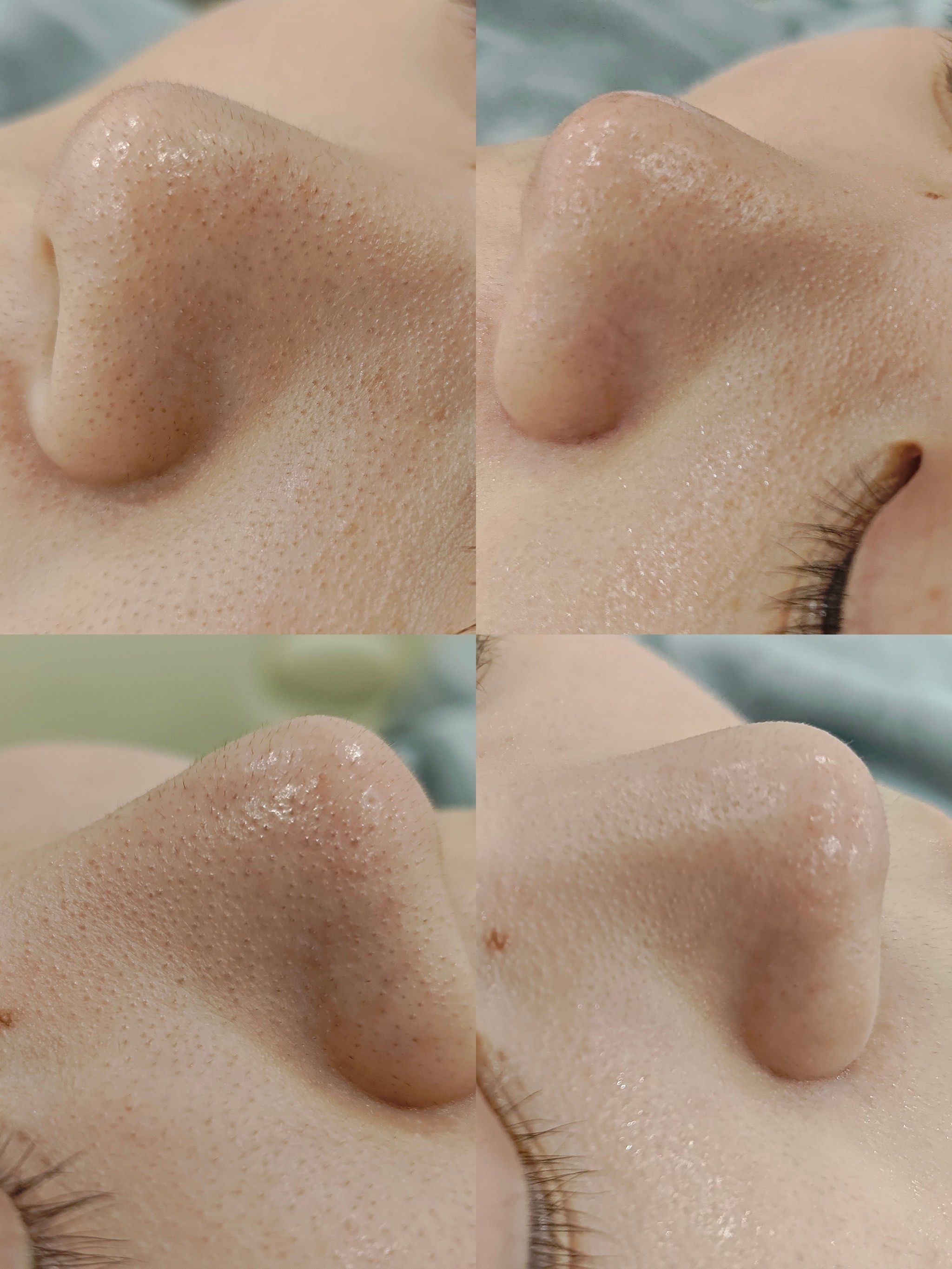 毛孔深层清洁天花板!