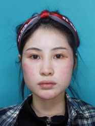 点击看大图 体验前-深圳艺星医疗美容医院