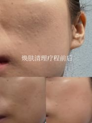-skin79皮肤管理中心