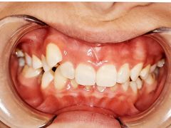 -宁波儿童口腔医院(钱湖院区)