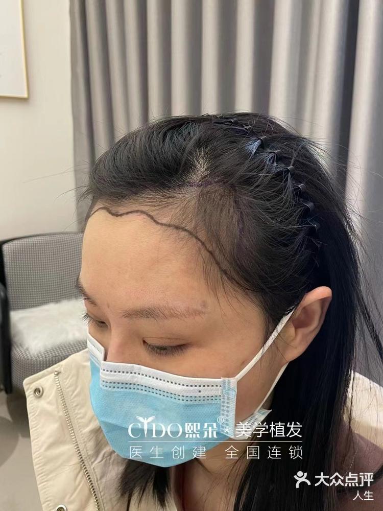 中国植发客(中国植发联盟)
