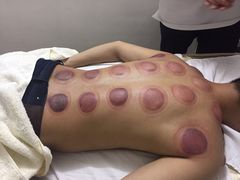 -安琪盲人按摩调理草本熏蒸馆(风和日丽店)