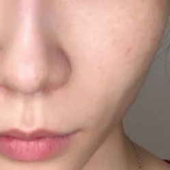 体验前-上海玫瑰医疗美容医院