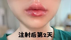 -八大处整形