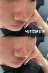 点击看大图 -苑苑vbeauty科技美容SPA