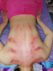 -涌泉妈咪树通乳·产后恢复