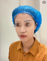 -美安心医美·美迪迈黄金微针·美拉美医疗美容